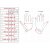 Patrice Catanzaro MOLLY Lack Handschuhe - Rot L / XL